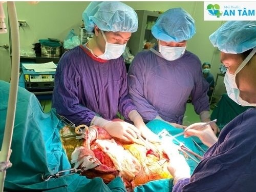 Thông tin cần biết về thải ghép thận